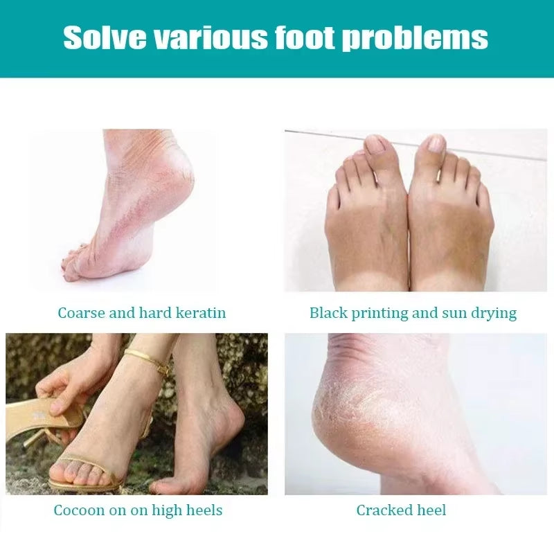 Disposable Foot Spa Covers – 100 Pack PE Pedicure Socks