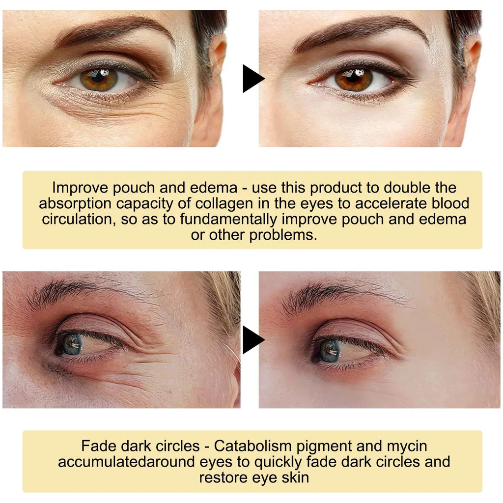 Gold-Style Under-Eye Gel Patches – 60/120/180 Pieces
