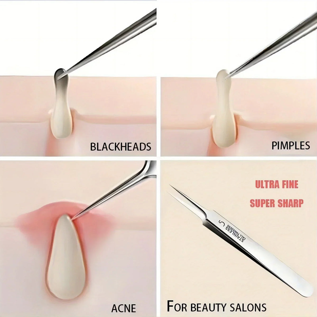 Fine-Tip Blackhead Removal Tweezers