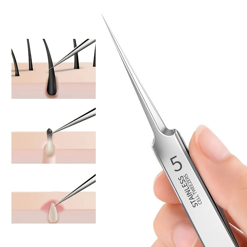 Fine-Tip Blackhead Removal Tweezers