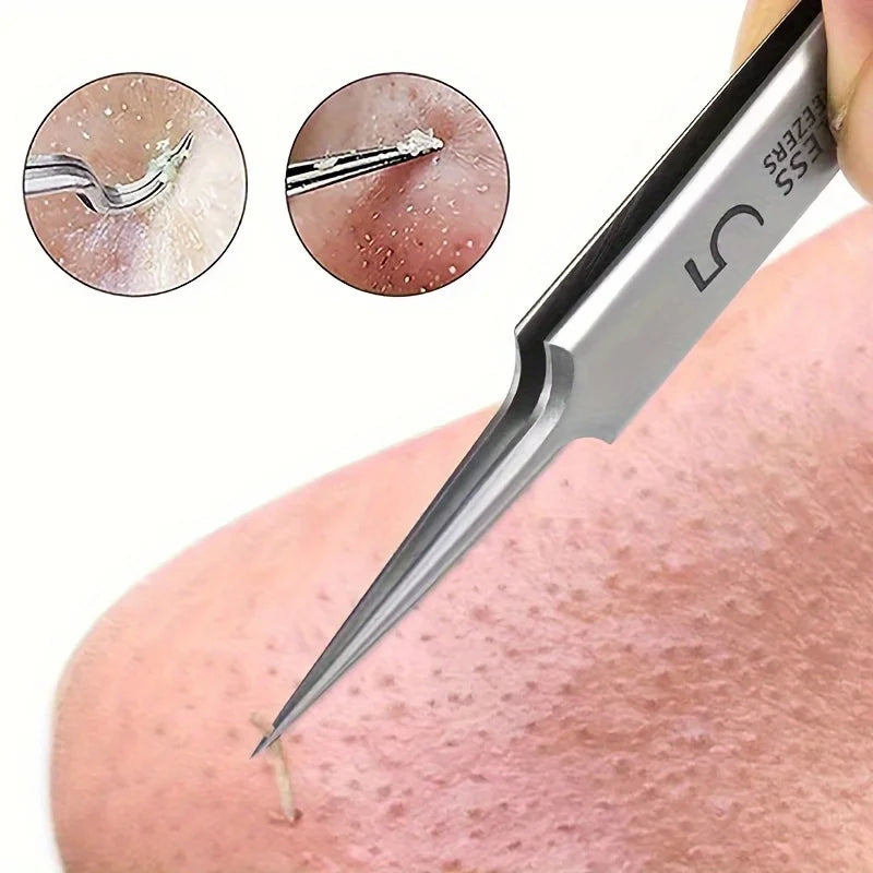 Fine-Tip Blackhead Removal Tweezers