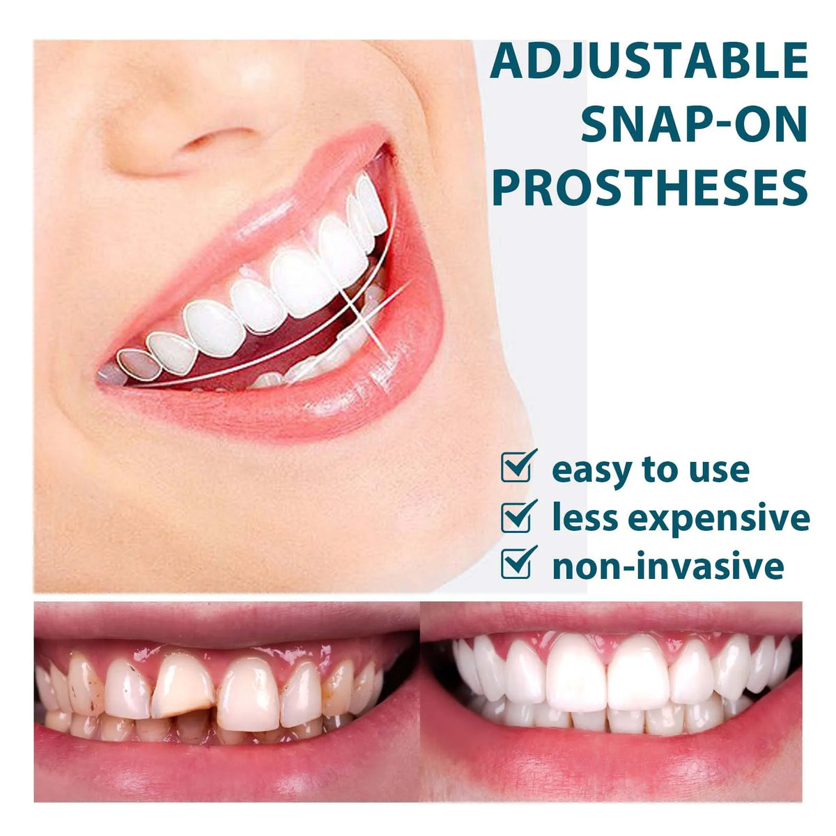 Teeth Veneers Whitening Dentures Braces Temporary False Teeth Cover Perfect Smile Comfortable Fit Denture Kit